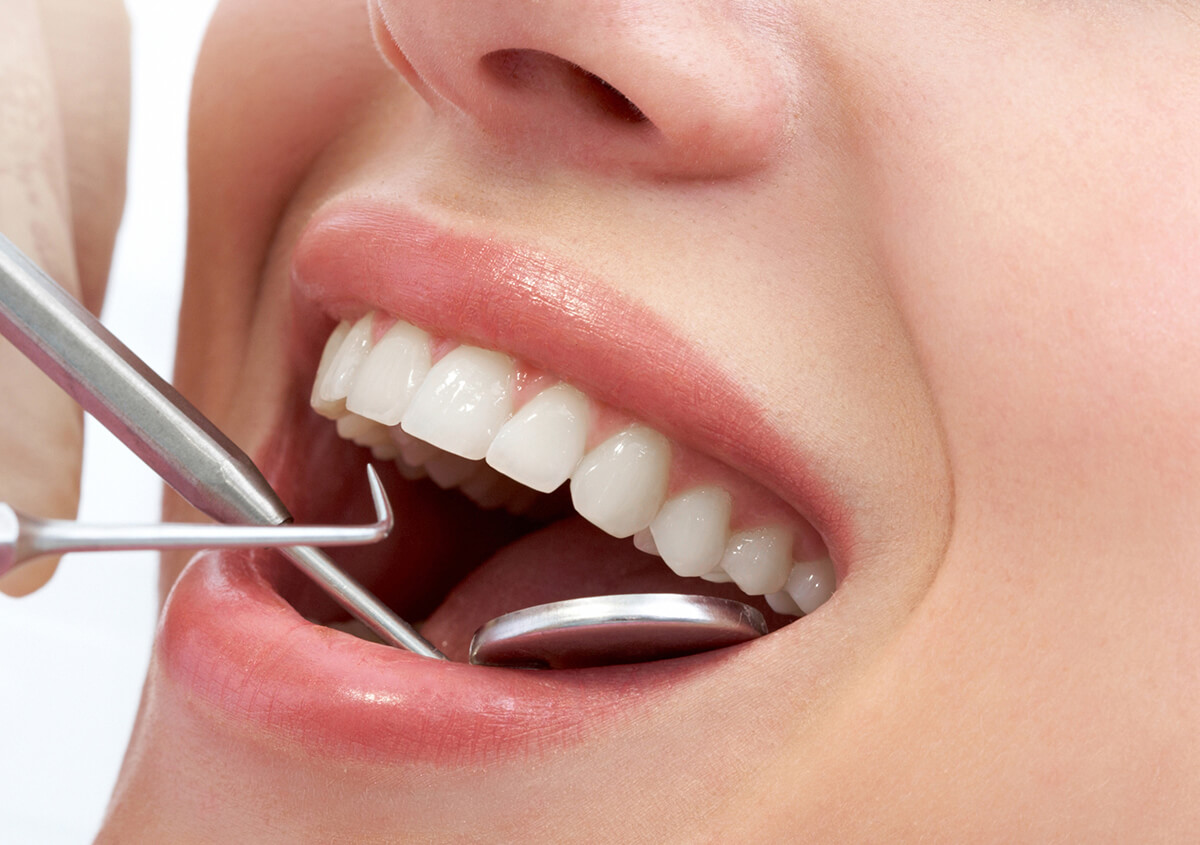 How Root Canal Treatment is Done in Lakewood Ranch FL Area